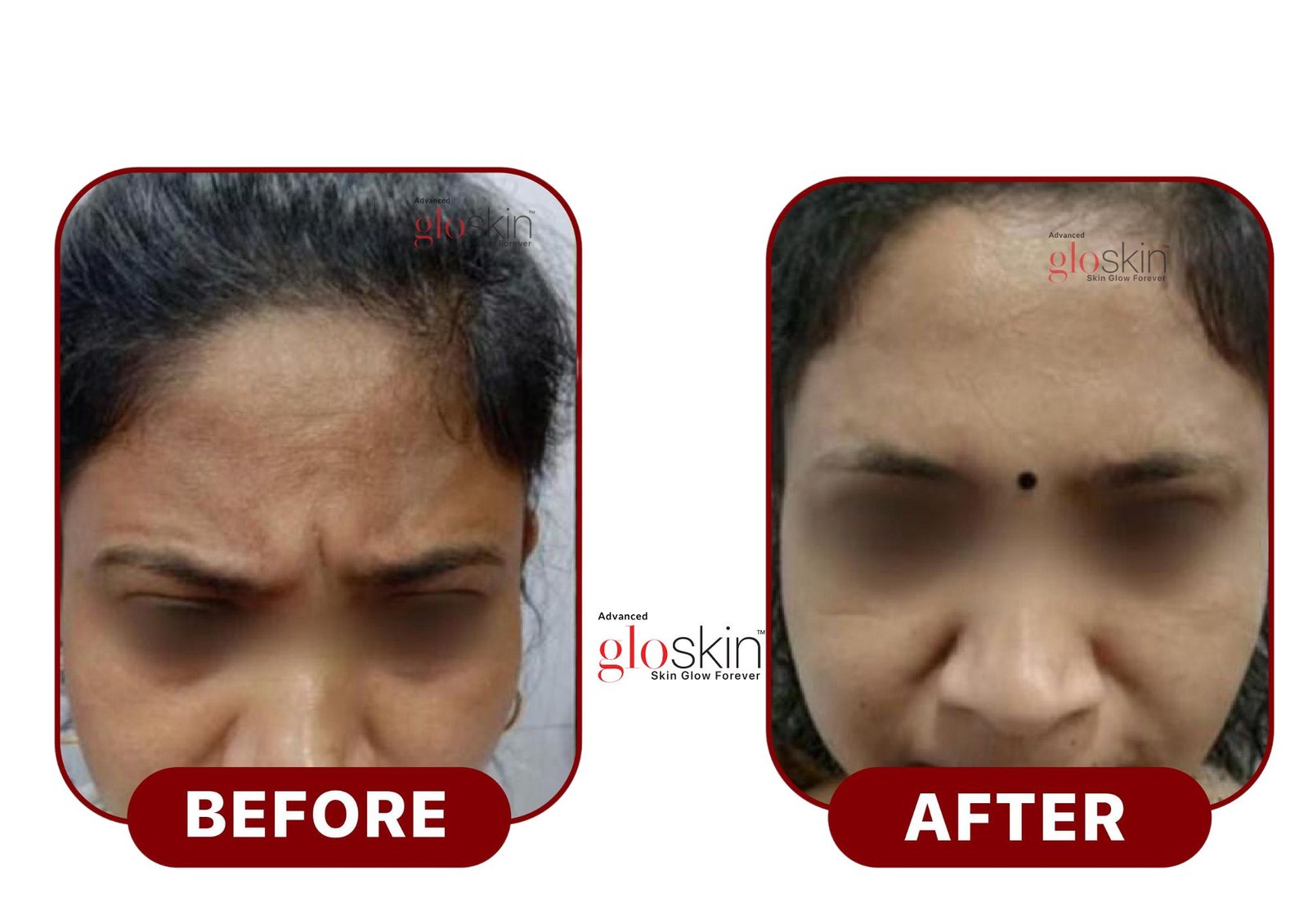 Adgloskin.pdf.jpg