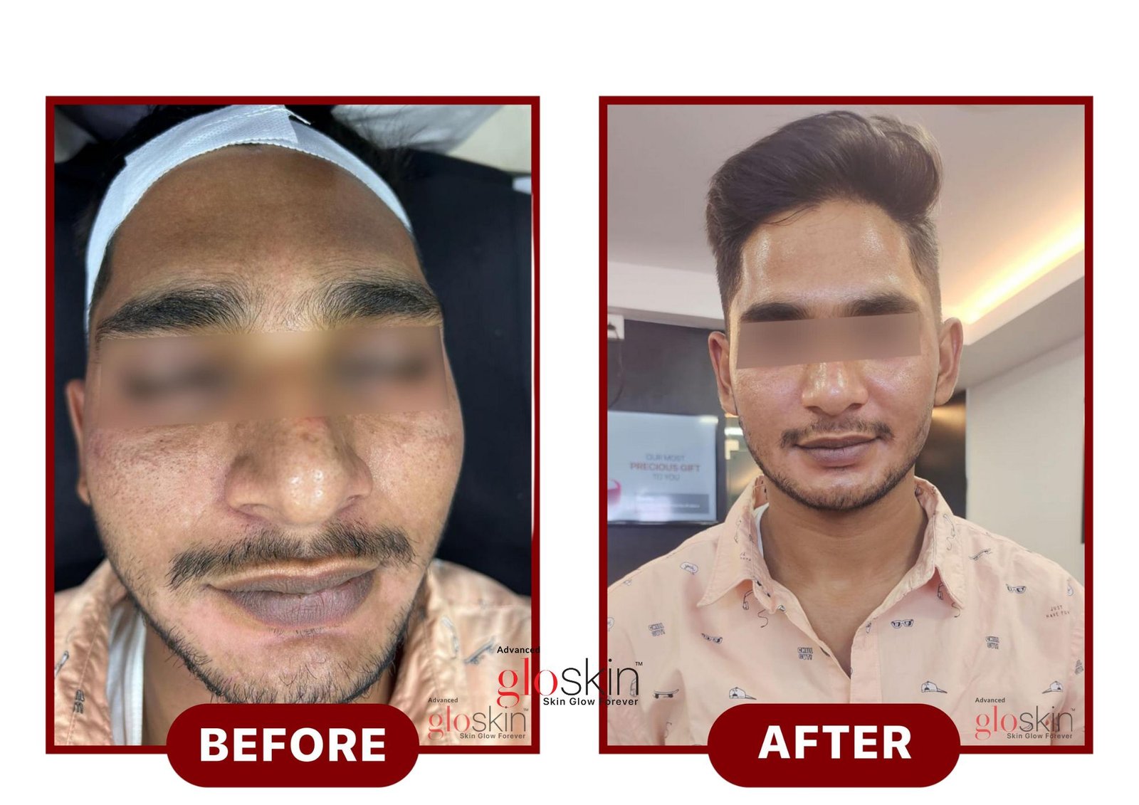 Hydrafacial.jpg